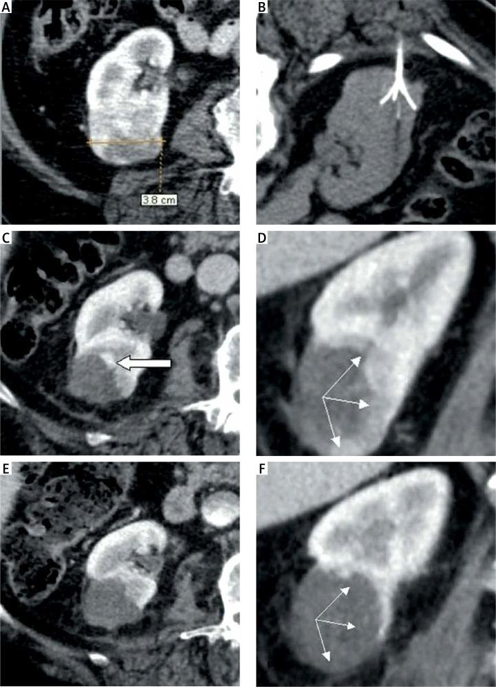 https://cdn.ncbi.nlm.nih.gov/pmc/blobs/41a4/5776489/fe306d9ef0aa/WIITM-12-31330-g005.jpg