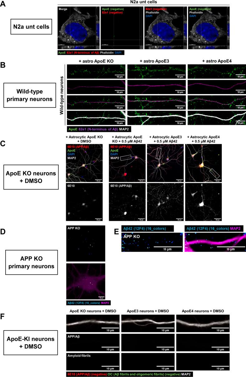 https://cdn.ncbi.nlm.nih.gov/pmc/blobs/41aa/10250689/f295527019cc/LSA-2022-01887_FigS5.jpg