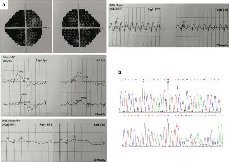 https://cdn.ncbi.nlm.nih.gov/pmc/blobs/41ac/8008643/74179730d3bb/12920_2021_935_Fig3_HTML.jpg