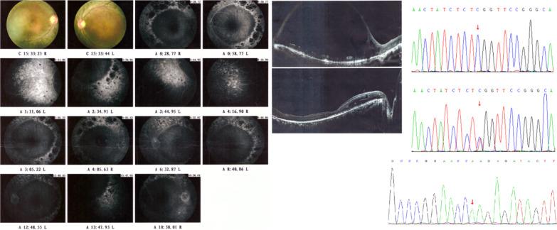 https://cdn.ncbi.nlm.nih.gov/pmc/blobs/41ac/8008643/e0f09aa96a87/12920_2021_935_Fig5_HTML.jpg