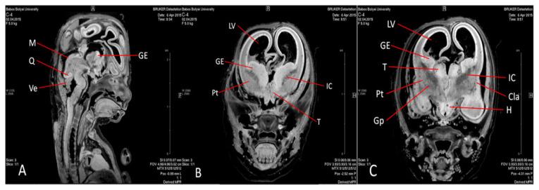 https://cdn.ncbi.nlm.nih.gov/pmc/blobs/41b1/7880059/856444dd15ce/cm-94-35f5.jpg