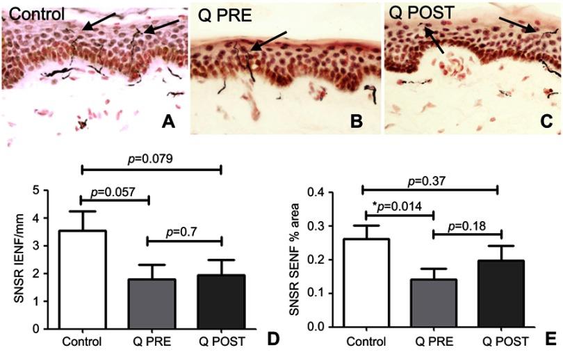 https://cdn.ncbi.nlm.nih.gov/pmc/blobs/41b4/6613356/1cc52d29d48b/JPR-12-2039-g0004.jpg