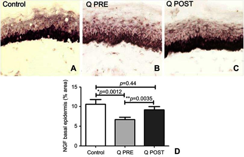 https://cdn.ncbi.nlm.nih.gov/pmc/blobs/41b4/6613356/1de0e7dd1002/JPR-12-2039-g0006.jpg