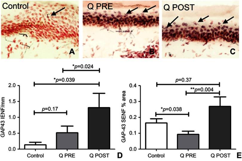 https://cdn.ncbi.nlm.nih.gov/pmc/blobs/41b4/6613356/bc6695365b27/JPR-12-2039-g0005.jpg