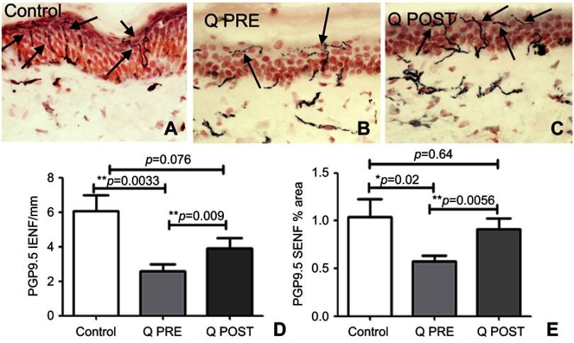 https://cdn.ncbi.nlm.nih.gov/pmc/blobs/41b4/6613356/d406ae0a2d27/JPR-12-2039-g0002.jpg