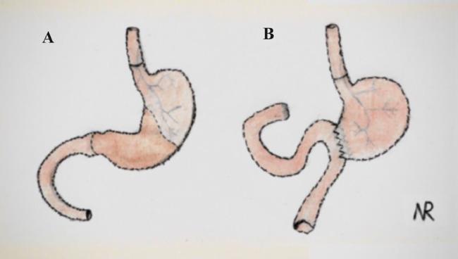 https://cdn.ncbi.nlm.nih.gov/pmc/blobs/41b5/12305705/0afcad1d63e8/gr1.jpg