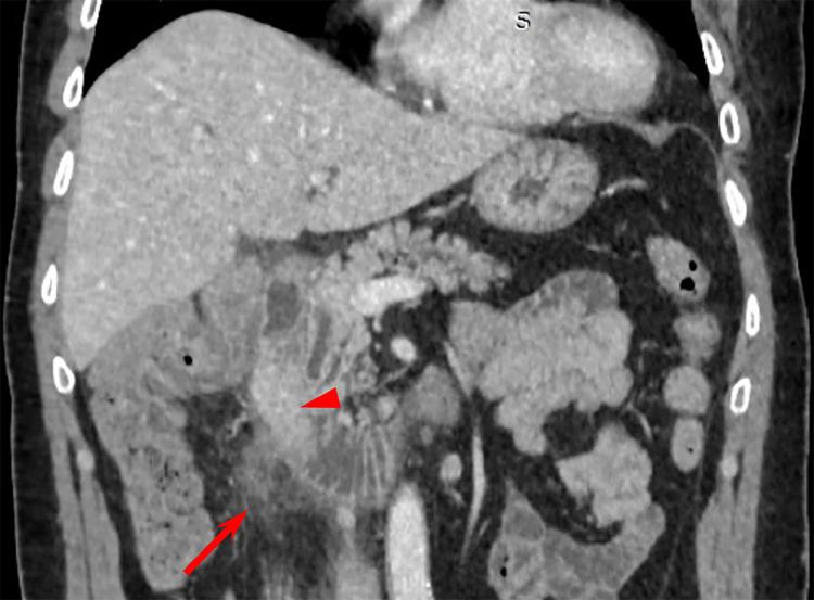 https://cdn.ncbi.nlm.nih.gov/pmc/blobs/41b5/12305705/f2f3c1f9d023/gr5.jpg