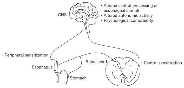 https://cdn.ncbi.nlm.nih.gov/pmc/blobs/41bf/5628981/6309904cc5b0/jnm-23-495f3.jpg