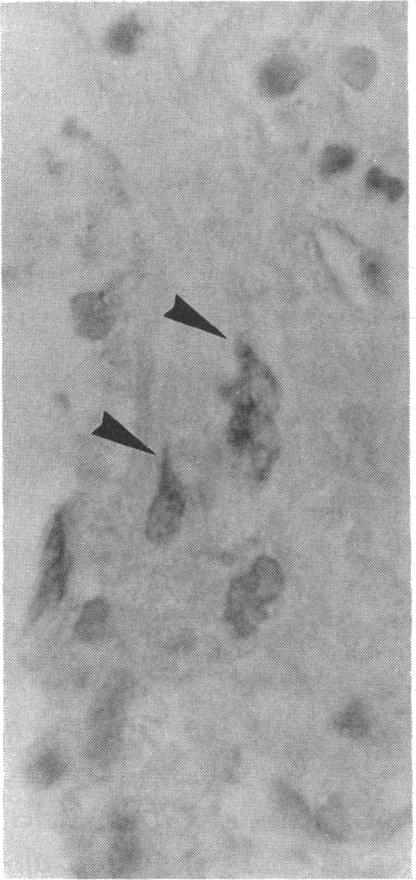 https://cdn.ncbi.nlm.nih.gov/pmc/blobs/41c8/303492/03938d9b05e4/jcinvest00079-0188-c.jpg