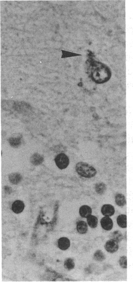 https://cdn.ncbi.nlm.nih.gov/pmc/blobs/41c8/303492/03d996c1f0e9/jcinvest00079-0188-a.jpg
