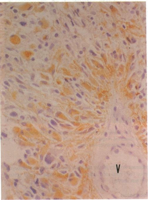 https://cdn.ncbi.nlm.nih.gov/pmc/blobs/41c8/303492/4c275bdd11e0/jcinvest00079-0191-a.jpg
