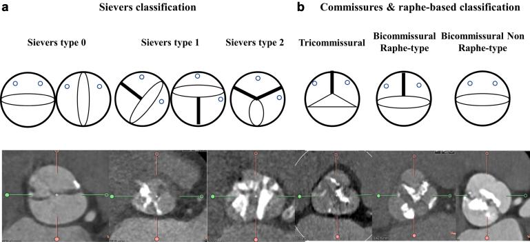 https://cdn.ncbi.nlm.nih.gov/pmc/blobs/41c9/10818151/1e0c7a9b7dcd/gr1.jpg