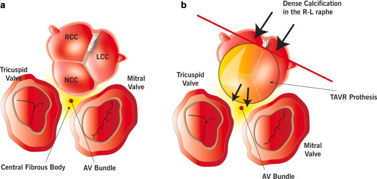 https://cdn.ncbi.nlm.nih.gov/pmc/blobs/41c9/10818151/54304e3fdd84/gr3.jpg