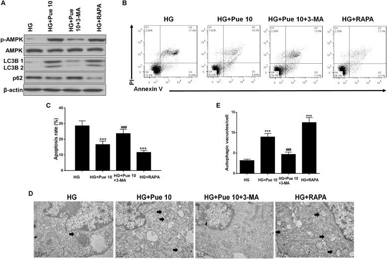 https://cdn.ncbi.nlm.nih.gov/pmc/blobs/41c9/7033627/fb91f942908e/fphys-11-00073-g007.jpg