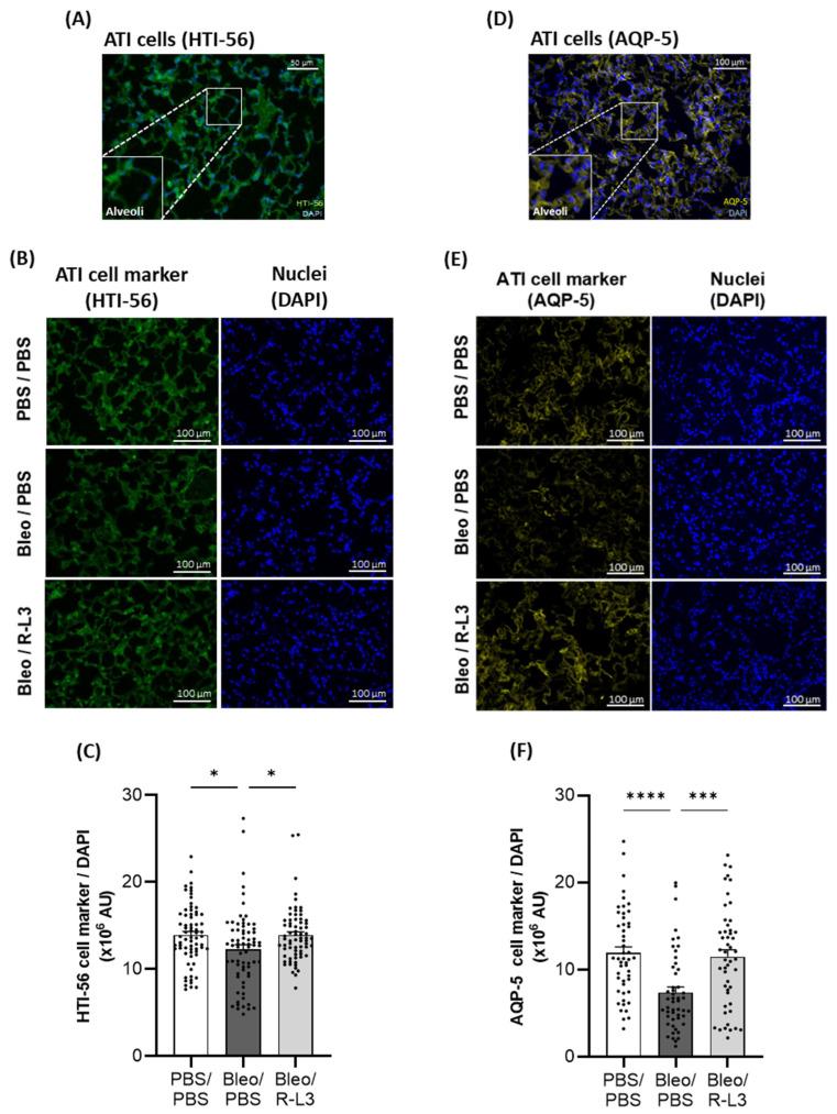 https://cdn.ncbi.nlm.nih.gov/pmc/blobs/41cb/12347741/7587bd4445a9/ijms-26-07632-g006.jpg