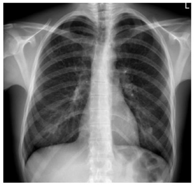 https://cdn.ncbi.nlm.nih.gov/pmc/blobs/41d3/7982411/2bd8ec9214b8/fmed-07-582581-g0002.jpg