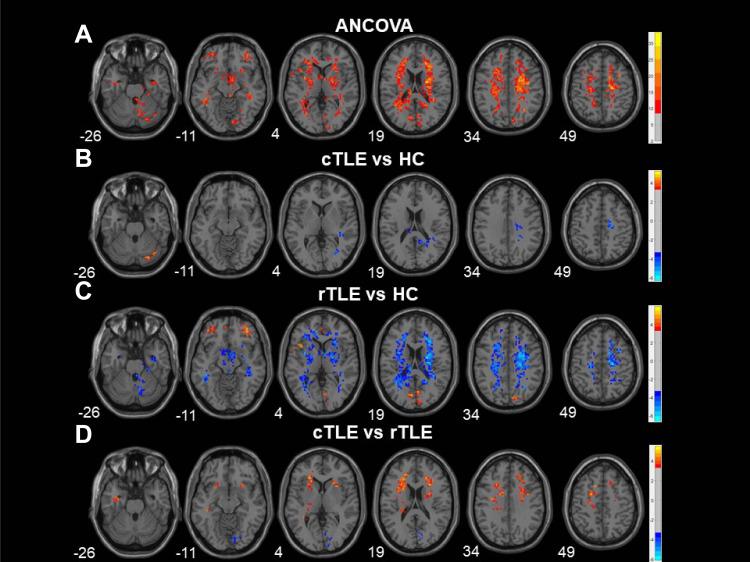 https://cdn.ncbi.nlm.nih.gov/pmc/blobs/41da/9170234/94a992f8e112/NDT-18-1107-g0001.jpg