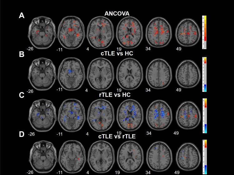 https://cdn.ncbi.nlm.nih.gov/pmc/blobs/41da/9170234/bf445f51631c/NDT-18-1107-g0002.jpg