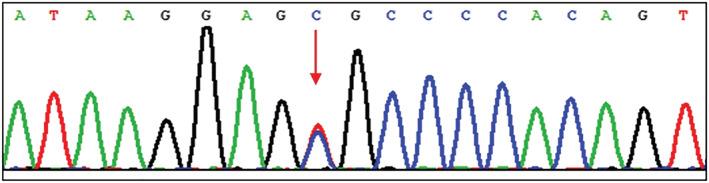 https://cdn.ncbi.nlm.nih.gov/pmc/blobs/41db/9829620/9c63cbcc3935/CRJ-17-50-g002.jpg
