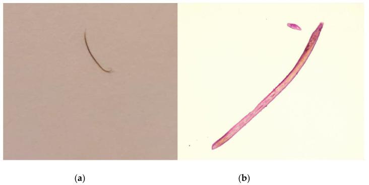 https://cdn.ncbi.nlm.nih.gov/pmc/blobs/41df/10178080/b2a05380187a/diagnostics-13-01575-g005.jpg