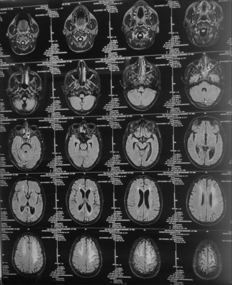 https://cdn.ncbi.nlm.nih.gov/pmc/blobs/41e6/12032600/1e49287022d0/IJPsy-67-354-g002.jpg