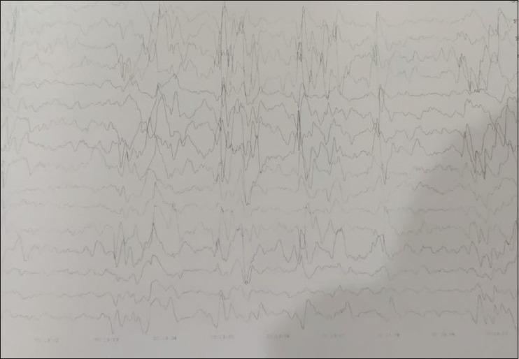 https://cdn.ncbi.nlm.nih.gov/pmc/blobs/41e6/12032600/f0ab5bd29763/IJPsy-67-354-g001.jpg