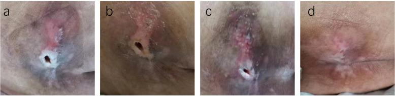 https://cdn.ncbi.nlm.nih.gov/pmc/blobs/41e6/12313496/4152afbb5242/fendo-16-1620730-g005.jpg