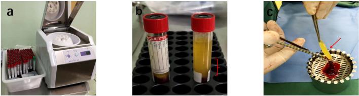 https://cdn.ncbi.nlm.nih.gov/pmc/blobs/41e6/12313496/ce320a03884a/fendo-16-1620730-g002.jpg