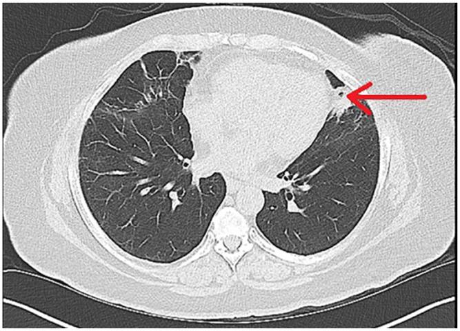 https://cdn.ncbi.nlm.nih.gov/pmc/blobs/41e6/8744194/ba8f266b9808/10.1177_23247096211063332-fig2.jpg