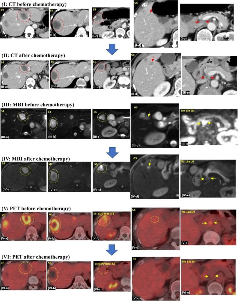 https://cdn.ncbi.nlm.nih.gov/pmc/blobs/41ee/7276394/cc25e9775d10/gr1.jpg