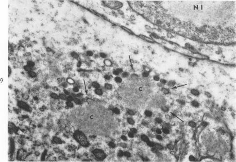 https://cdn.ncbi.nlm.nih.gov/pmc/blobs/41f7/1949693/14051465826d/amjpathol00314-0043-b.jpg