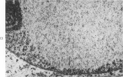 https://cdn.ncbi.nlm.nih.gov/pmc/blobs/41f7/1949693/2e6c69704853/amjpathol00314-0045-b.jpg
