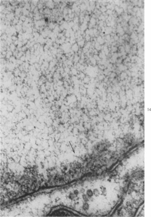 https://cdn.ncbi.nlm.nih.gov/pmc/blobs/41f7/1949693/8ecb57b4e9c1/amjpathol00314-0046-a.jpg