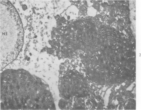 https://cdn.ncbi.nlm.nih.gov/pmc/blobs/41f7/1949693/bf6967f0a8a5/amjpathol00314-0038-b.jpg