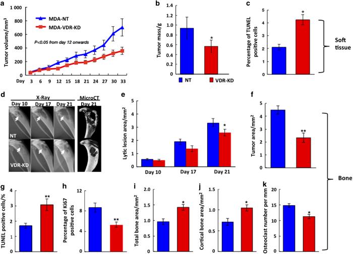 https://cdn.ncbi.nlm.nih.gov/pmc/blobs/41f7/5605769/3419c60027c9/boneres201723-f2.jpg