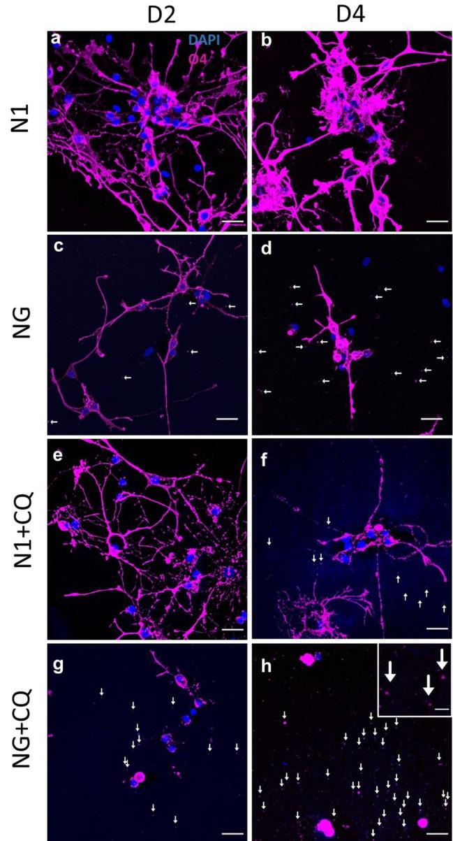 https://cdn.ncbi.nlm.nih.gov/pmc/blobs/41fb/10320974/2b7cb0d158f3/40478_2023_1601_Fig4_HTML.jpg