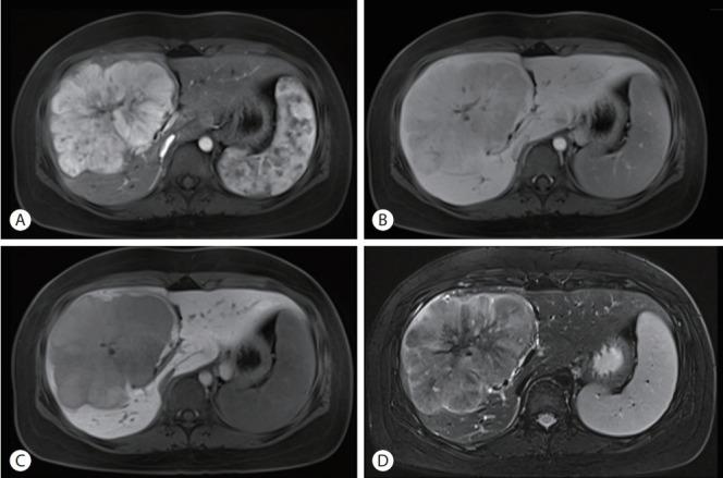 https://cdn.ncbi.nlm.nih.gov/pmc/blobs/41fe/10035731/c36bf72704c6/jlc-2022-06-10f2.jpg
