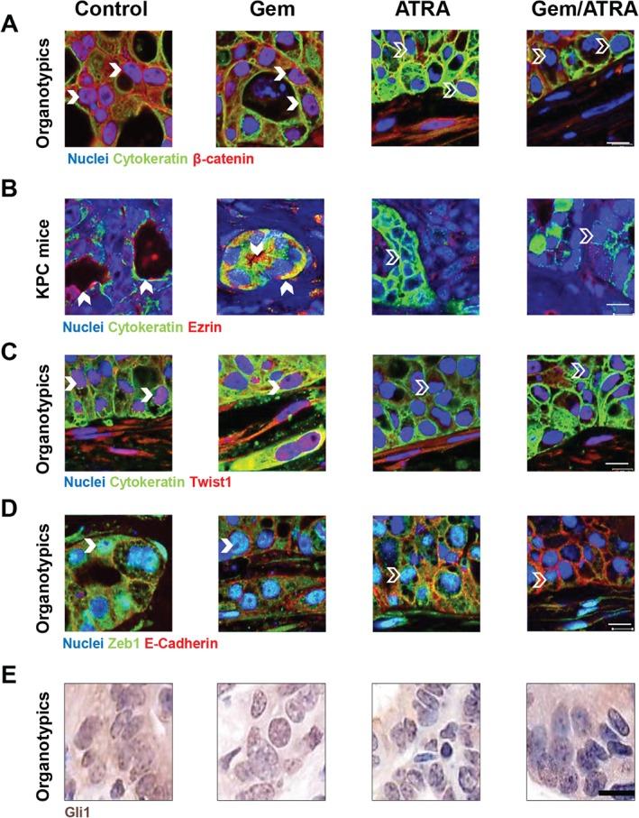 https://cdn.ncbi.nlm.nih.gov/pmc/blobs/4200/5025731/36b9d81731b0/PATH-239-286-g003.jpg