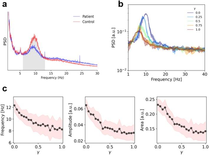 https://cdn.ncbi.nlm.nih.gov/pmc/blobs/4203/12048862/5a92b10bed29/HBM-46-e70219-g004.jpg