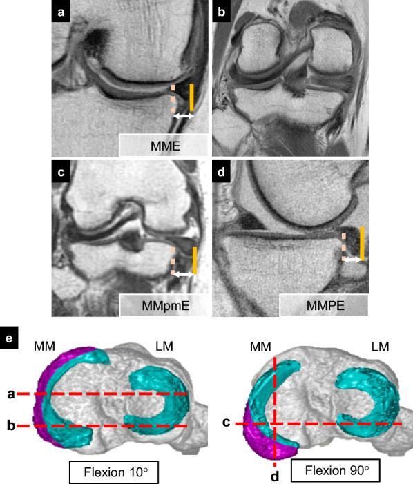 https://cdn.ncbi.nlm.nih.gov/pmc/blobs/420a/11969855/6e802420c8a0/43019_2025_264_Fig4_HTML.jpg