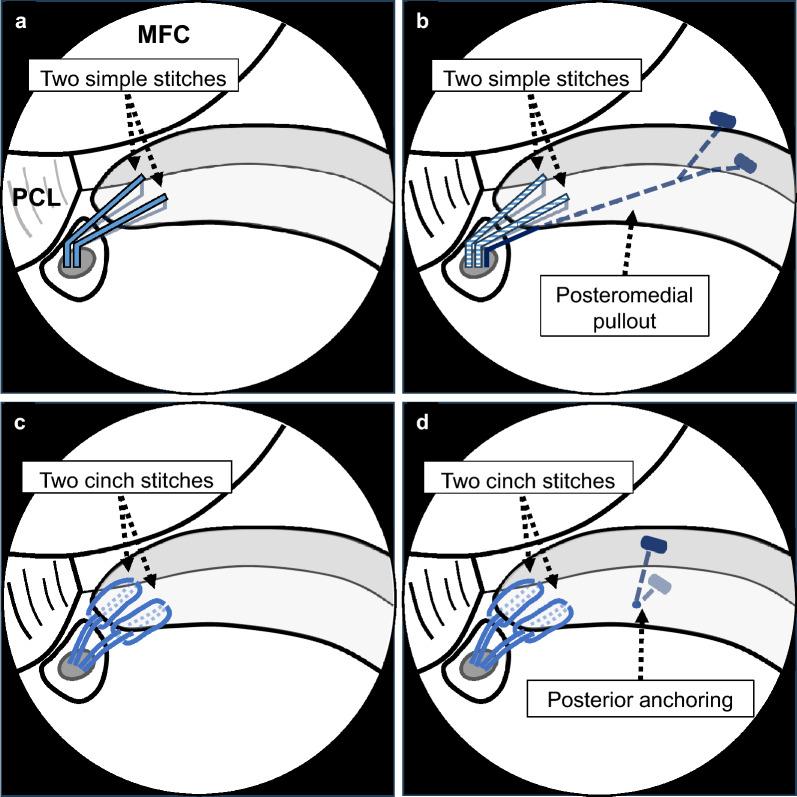 https://cdn.ncbi.nlm.nih.gov/pmc/blobs/420a/11969855/fd8e48ae5934/43019_2025_264_Fig1_HTML.jpg
