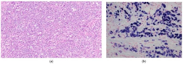 https://cdn.ncbi.nlm.nih.gov/pmc/blobs/420b/11435077/926be5fae96a/pathogens-13-00728-g001.jpg