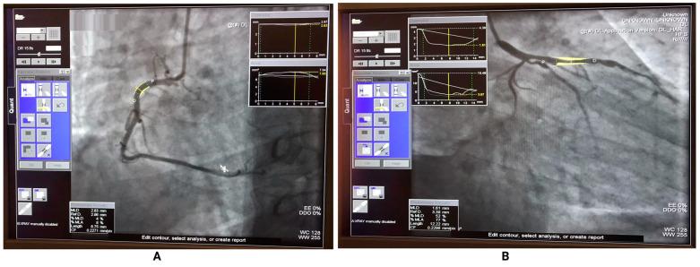 https://cdn.ncbi.nlm.nih.gov/pmc/blobs/420f/10340769/2b21deda4863/diagnostics-13-02274-g004.jpg