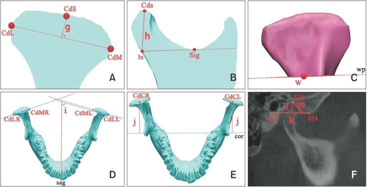 https://cdn.ncbi.nlm.nih.gov/pmc/blobs/4214/5548708/c149d45ae162/kjod-47-277-g003.jpg