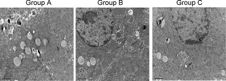 https://cdn.ncbi.nlm.nih.gov/pmc/blobs/421b/5997796/bb5f2b04e553/bsr-38-bsr20171035-g5.jpg