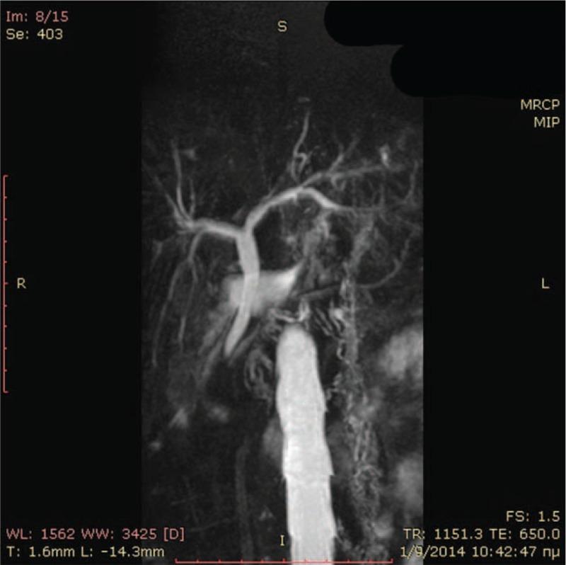 https://cdn.ncbi.nlm.nih.gov/pmc/blobs/421c/4706259/8eaf2dd8c8fc/medi-95-e2394-g003.jpg