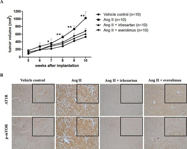 https://cdn.ncbi.nlm.nih.gov/pmc/blobs/4228/5341864/676067024645/oncotarget-07-67150-g005.jpg