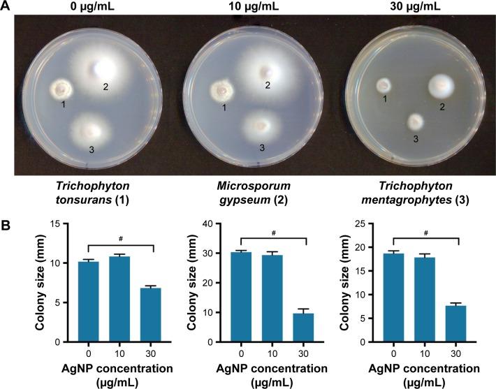https://cdn.ncbi.nlm.nih.gov/pmc/blobs/4229/5798539/a5d048e82a86/ijn-13-695Fig4.jpg