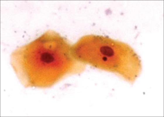 https://cdn.ncbi.nlm.nih.gov/pmc/blobs/422b/3425103/4accb2ec6189/CCD-3-184-g001.jpg