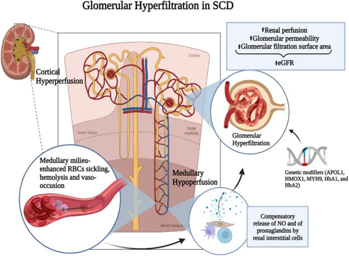 https://cdn.ncbi.nlm.nih.gov/pmc/blobs/422c/9633850/3b81a0d3307e/fmed-09-1029224-g001.jpg